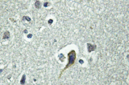 AP01263PU-N - PTH Receptor 1