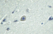 AP01265PU-N - Cannabinoid receptor 1