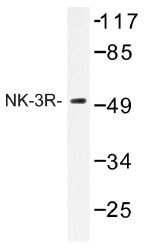 AP01273PU-N - Tachykinin receptor 3 (TACR3)