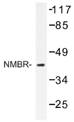 AP01274PU-N - Neuromedin B receptor