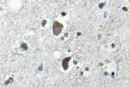 AP01275PU-N - Heat shock protein 70 / HSP70
