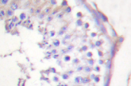 AP01276PU-N - LIPE