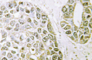 AP01281PU-N - hnRNP-M / HNRNPM