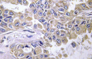AP01289PU-N - Laminin beta-2