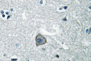 AP01291PU-N - Serotonin receptor 2C (HTR2C)