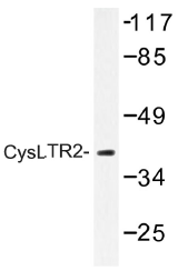 AP01297PU-N - CYSLTR2
