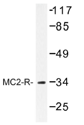 AP01306PU-N - MC2-R