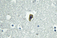 AP01307PU-N - BAI1