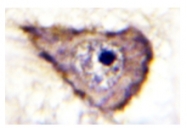 AP01883PU-N - VEGFR-1 / Flt-1