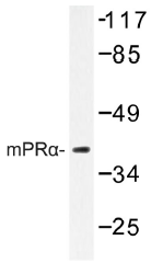 AP01321PU-N - PAQR7 / MRPA