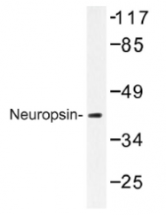 AP01329PU-N - Neuroserpin / SERPINI1