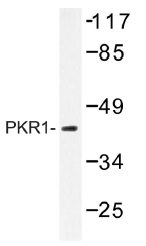 AP01335PU-N - PRKAR1A
