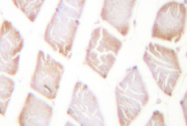 AP01349PU-N - AKT1 / PKB