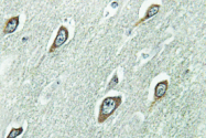 AP01351PU-N - Calmodulin