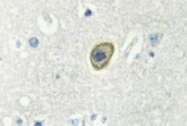 AP01353PU-N - CD115