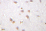 AP01354PU-N - Catenin delta-1