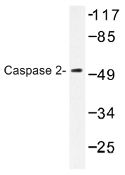 AP01357PU-N - Caspase-2