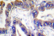 AP01357PU-N - Caspase-2