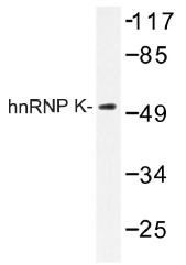 AP01359PU-N - hnRNP-K / HNRNPK