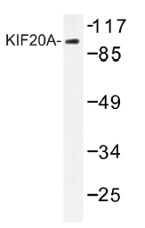 AP01361PU-N - KIF20A