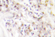 AP01361PU-N - KIF20A