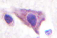 AP01362PU-N - KCNJ16