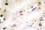 AP01366PU-N - TIS11B / ZFP36L1