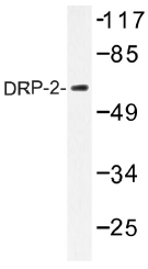 AP01367PU-N - DRP2