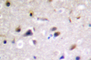 AP01367PU-N - DRP2