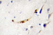 AP01369PU-N - ZFHX1B