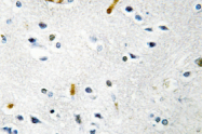 AP01372PU-N - TPX2 / DIL2
