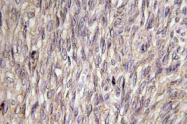 AP01375PU-N - FGF22