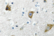 AP01378PU-N - RPS20