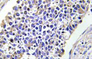 AP01380PU-N - AKR1B1 / ALDR1