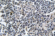 AP01383PU-N - Arfaptin-1
