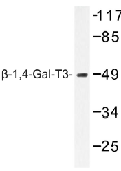 AP01385PU-N - B4GALT3