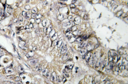 AP01387PU-N - ARFGEF2