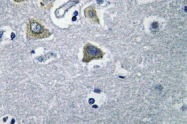 AP01389PU-N - Carbonic anhydrase 5B