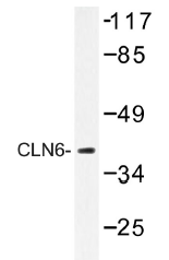 AP01390PU-N - CLN6