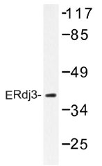 AP01395PU-N - DNAJB11