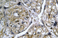 AP01397PU-N - INSL4 / EPIL