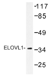 AP01399PU-N - ELOVL1