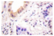 AP01835PU-N - MEF2D