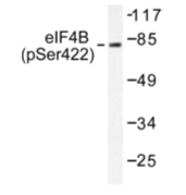 AP01821PU-N - EIF4B