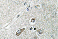 AP01409PU-N - ACSL6