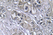 AP01414PU-N - SERPINA5