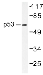 AP01418PU-N - TP53 / p53