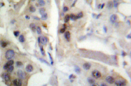 AP01419PU-N - RELA / NF-kB p65