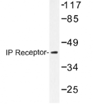 AP01428PU-N - Prostacyclin receptor / PTGIR