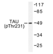 AP01763PU-N - MAPT / TAU